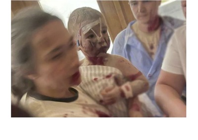 Immagine 1 bombardamento ospedale Ucraina